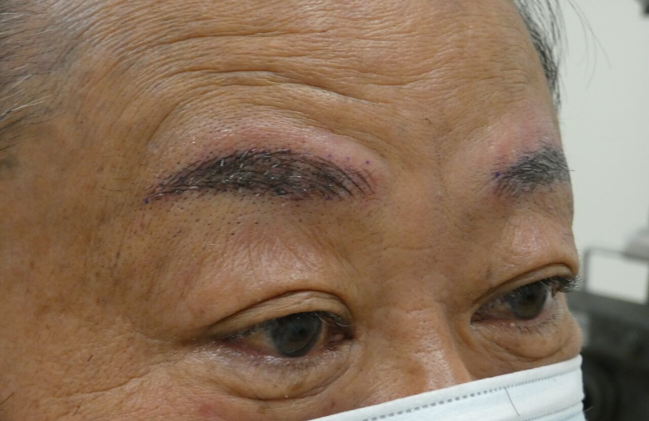 男性のアートメイク 眼瞼下垂とアートメイクの緒方眼科クリニック 大田区蒲田駅近く 男性のアートメイク 眼瞼下垂とアートメイクの緒方眼科クリニック 大田区蒲田駅近く