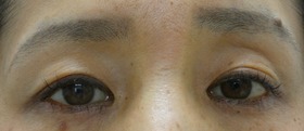 P1020164 (2)