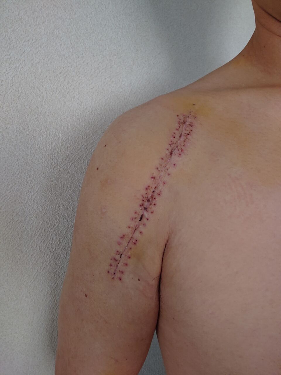 修理完了 グロ注意 今日はなにしよ 修理完了 グロ注意 今日はなにしよ