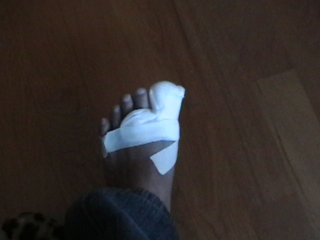 Hideのお暇日記 痛かった 生爪剥がしっちゃって