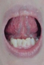 20151029舌裏