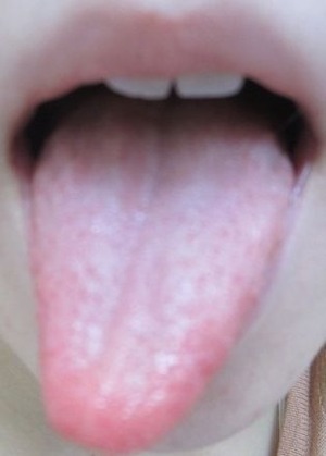 20130327舌表画像 010