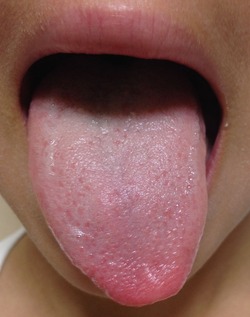 blog1