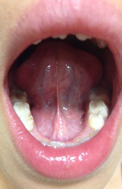 blog2