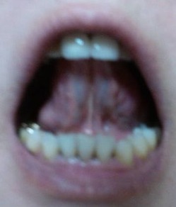20140618舌裏