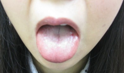 20111122舌表