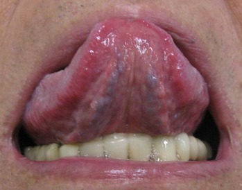 IMG_0961�ȥ�ߥ���΢