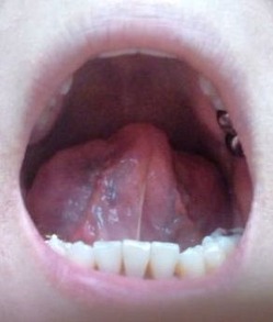 20140218舌裏
