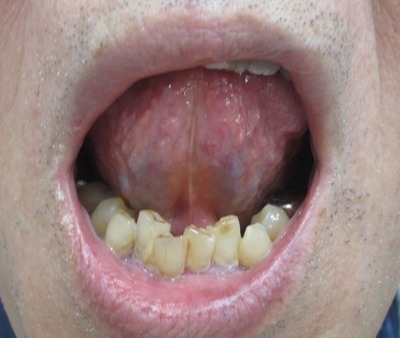 20121219��΢���� 036