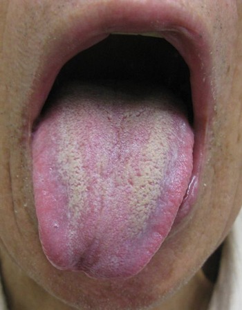 IMG_0960�ȥ�ߥ�