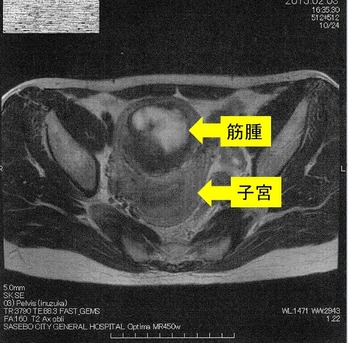 20150203�ҵܶڼ����1 - ���ԡ�