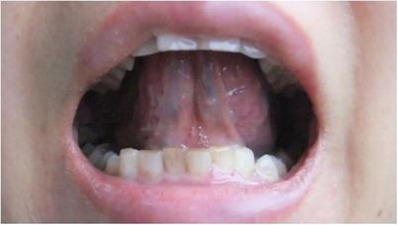 ���Ѹ���΢