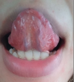 20150610舌裏
