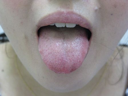 2010.10.8 舌表