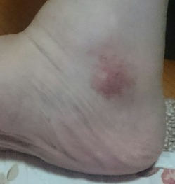 20160819¼ó