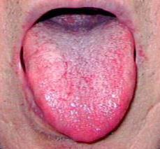 20130308���ɽ�֥�����