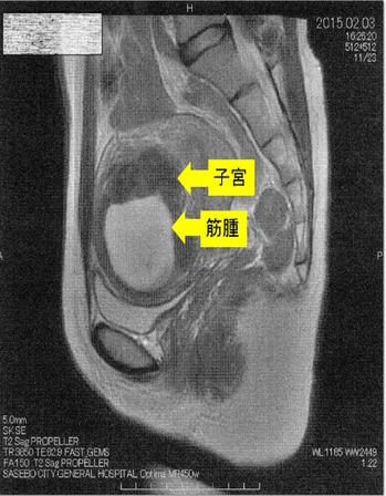 20150203�ҵܶڼ����3 - ���ԡ�