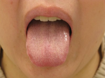 20110530舌表