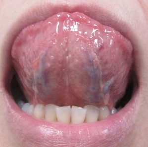 2015ǯ2��12�����΢