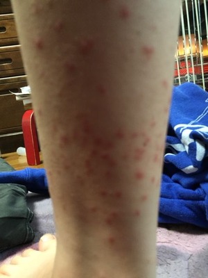 20150311足ふくらはぎ