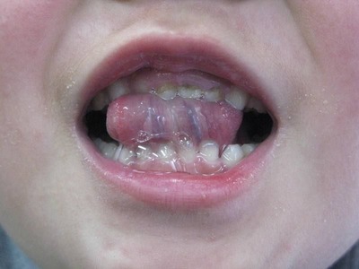 20110223舌裏