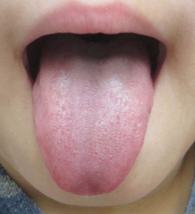 20130209��ɽ