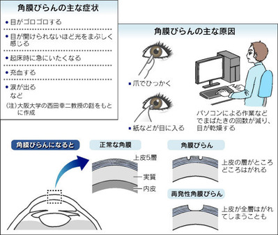 �ܤ�����