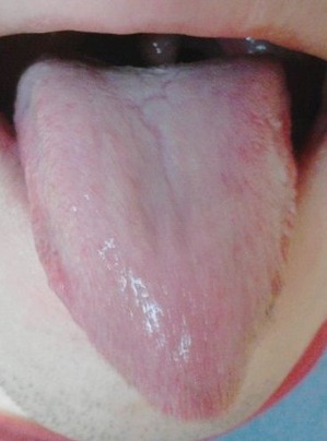 20150830舌の表
