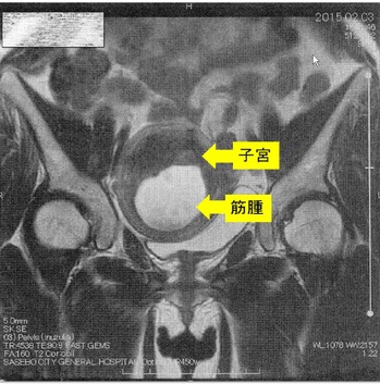 20150203�ҵܶڼ����4 - ���ԡ�