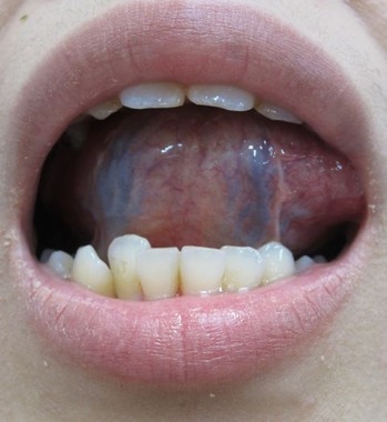 20121207Àå΢²èÁü 002