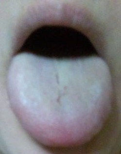 20140618舌表