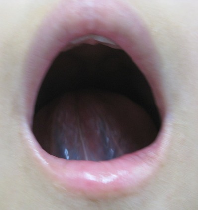 20120728��΢