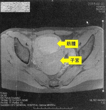 20150203�ҵܶڼ����2 - ���ԡ�