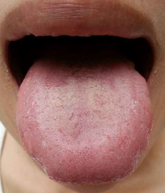 木室ミヱ子の漢方薬 13年12月 Livedoor Blog ブログ