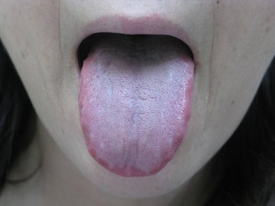 20110815舌表