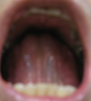 20111208舌の裏