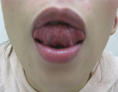 ���� 002�Ȥ�ߤ󤰴��������Ѹ塡��΢