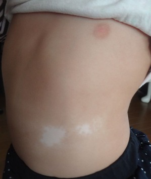 20141130����