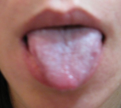 IMG_8434 ¥È¥ê¥ß¥ó¥°Àåɽ