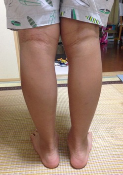 20160805­�θ��