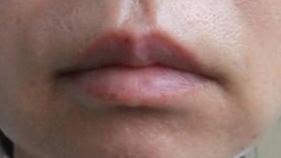 ���Ѹ忰��