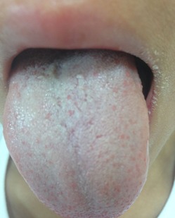 blog1