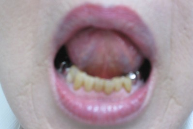 ���� 052�ȥ�ߥ���΢