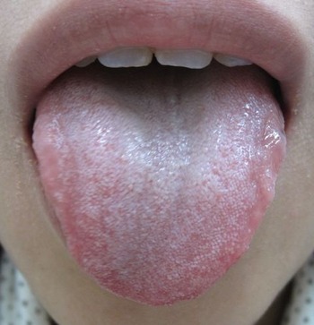 20121207Àåɽ²èÁü 001