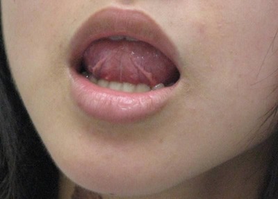 20110810��΢