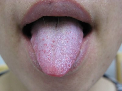 ��������ɽ