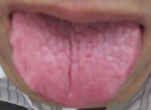 20130422舌の表