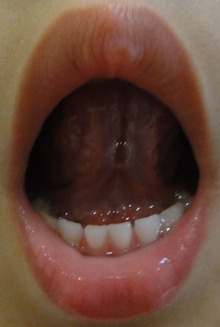 20130921舌裏