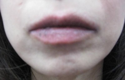 20110717��