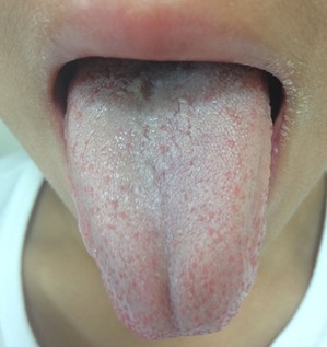 舌の表